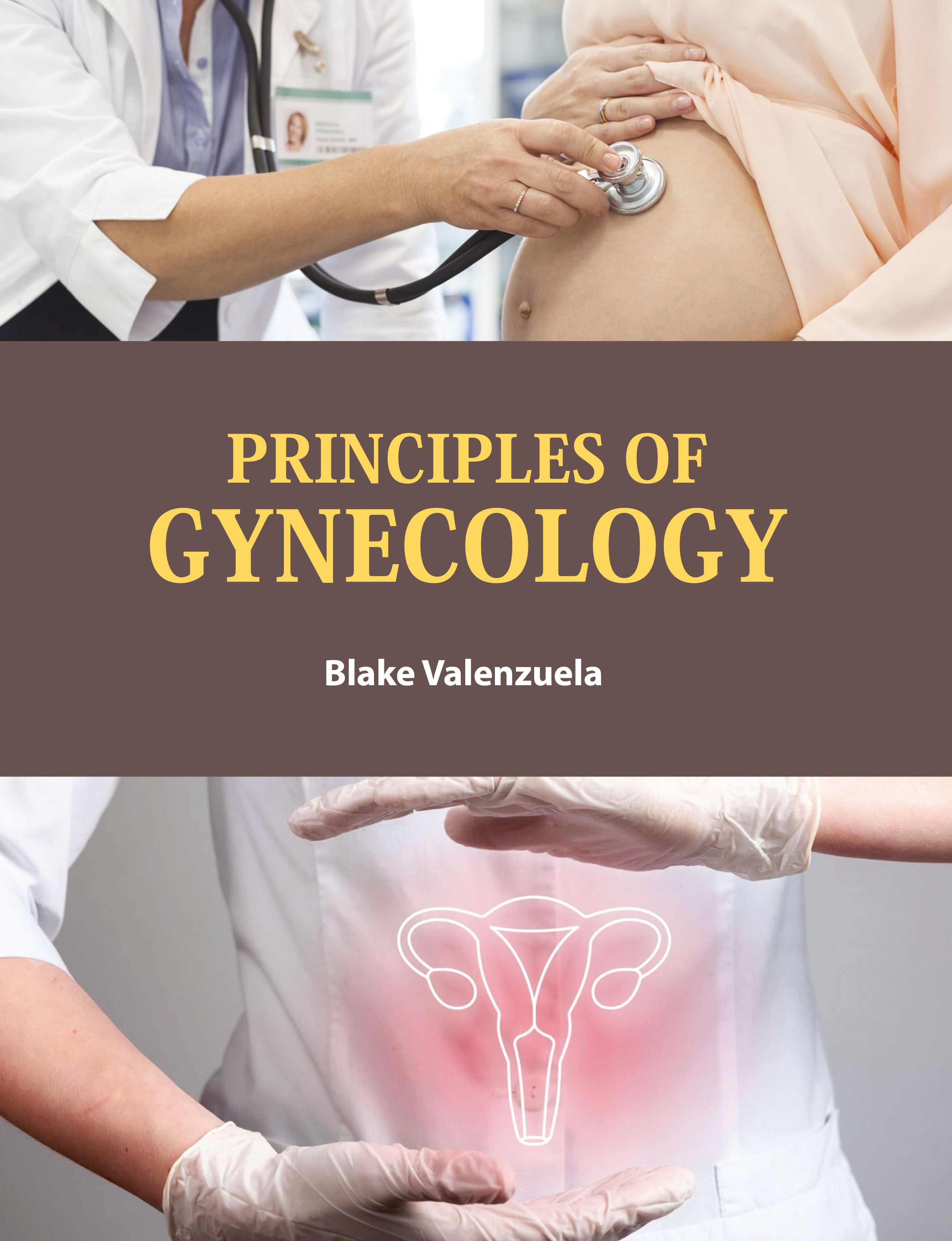 Principles of Gynecology