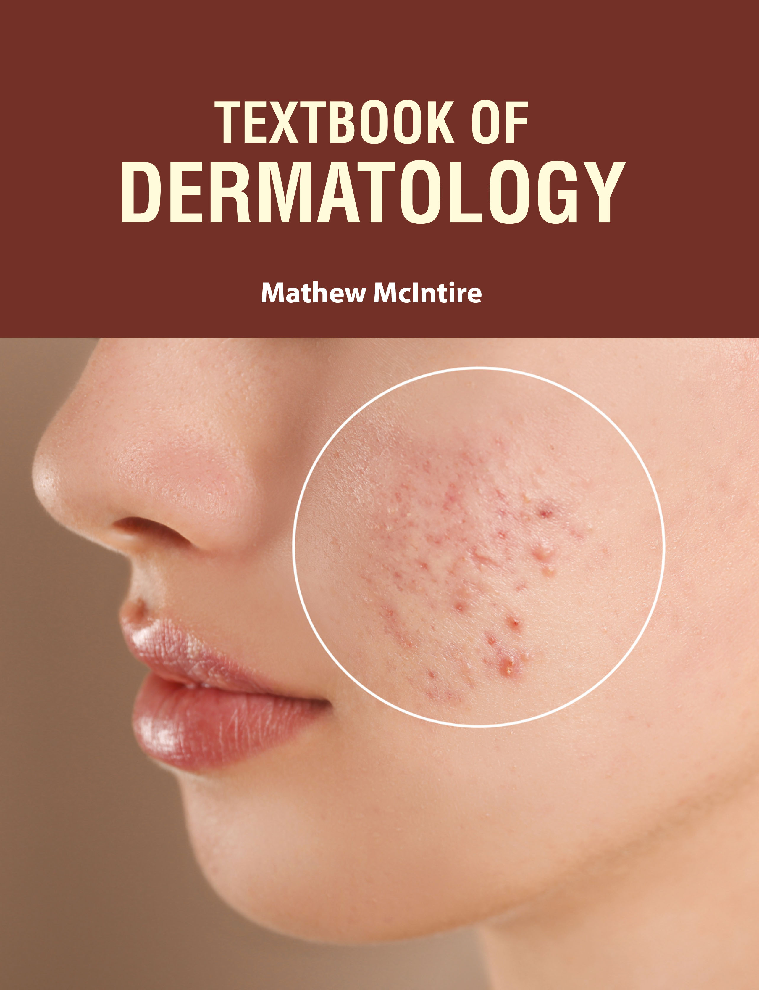 Textbook of Dermatology