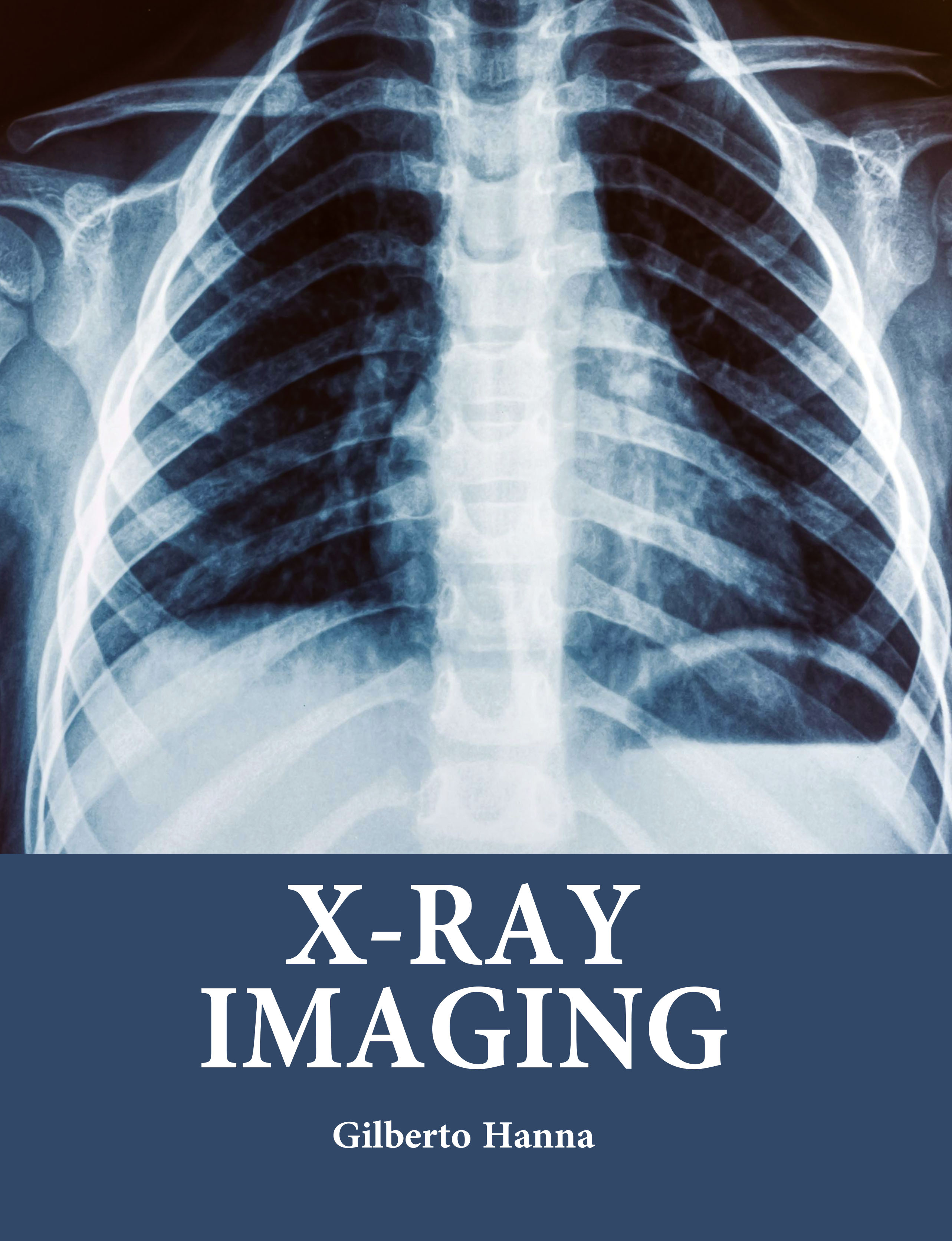 XRay Imaging
